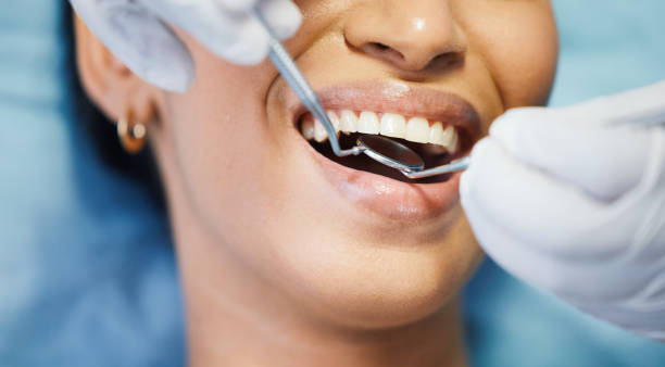Best Emergency Broken Tooth Repair in Simi Valley, CA